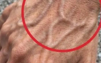 🖐️ If Your Hand Veins Are Visible, Here’s What Your Body May Be Telling You