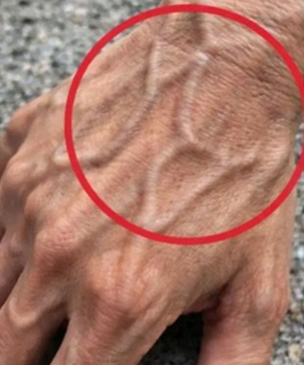 🖐️ If Your Hand Veins Are Visible, Here’s What Your Body May Be Telling You