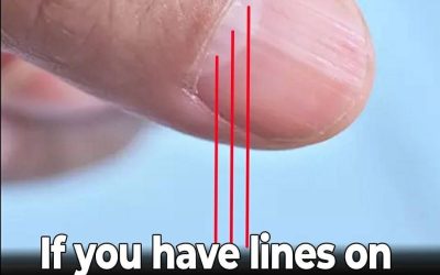 Doctor Uncovers A Telltale Sign In Your Fingernails That May Predict Your Life Expectancy