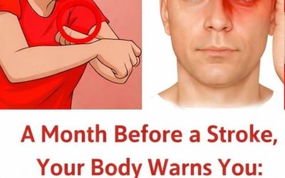 A month before a stroke, your body warns you: 10 signs not to ignore