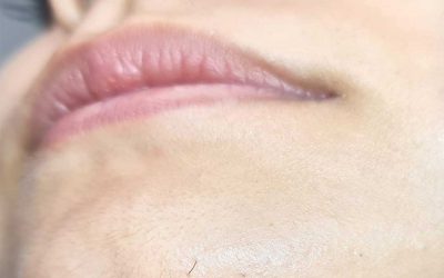 Surprised by Chin Whiskers? You’re Not Alone