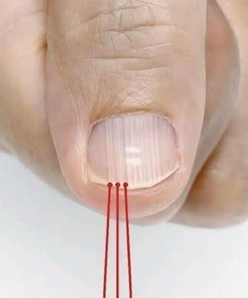 Vertical streaks on the nails: your body’s hidden message