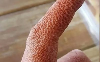 ALERT These are the signs that it is cre…See more