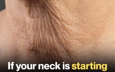 Why Neck Skin Sags as You Age — And What You Can Do About It