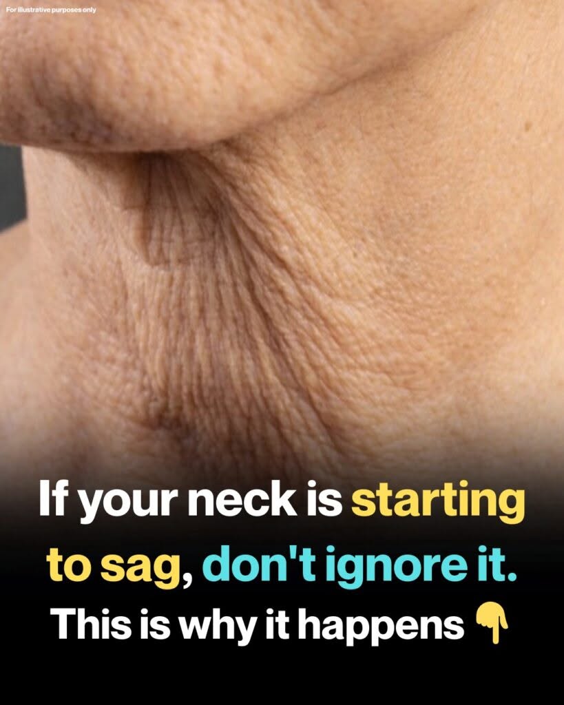 Why Neck Skin Sags as You Age — And What You Can Do About It